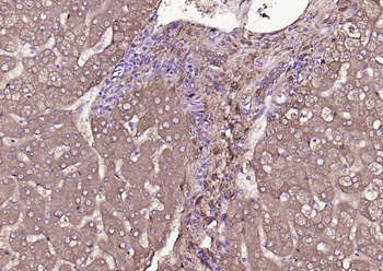 ALDH1A1 Recombinant Rabbit Monoclonal Antibody