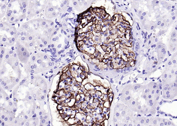 CD35 Recombinant Rabbit Monoclonal Antibody