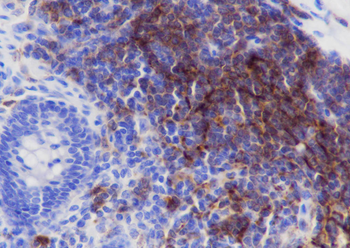 CD35 Recombinant Rabbit Monoclonal Antibody