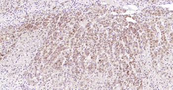 Inhibin alpha Recombinant Rabbit Monoclonal Antibody