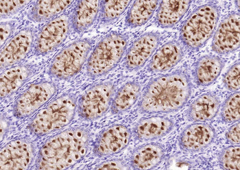 MUC2 Rabbit Polyclonal Antibody