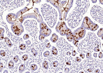 MUC2 Rabbit Polyclonal Antibody