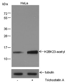 Histone H2B (Acetyl K23) Mouse Monoclonal Antibody