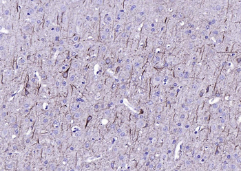 NF-L Mouse Monoclonal Antibody