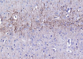 NF-L Mouse Monoclonal Antibody