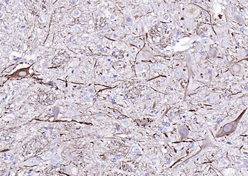 NF-L Mouse Monoclonal Antibody