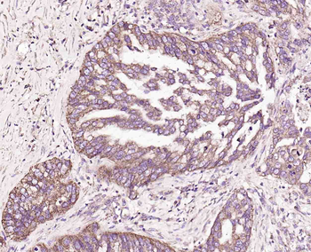 CD48 Rabbit Polyclonal Antibody