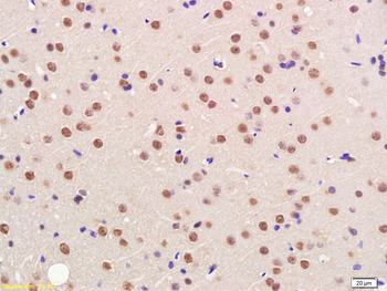 FBH1 Rabbit Polyclonal Antibody
