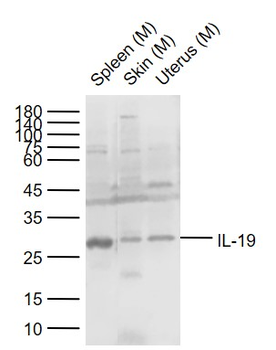 IL-19 Rabbit Polyclonal Antibody