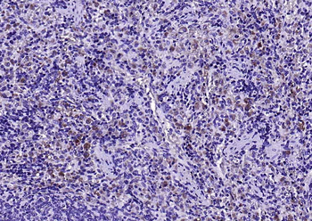 VSTM1 Rabbit Polyclonal Antibody
