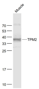 TPM2 Rabbit Polyclonal Antibody