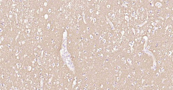 Tau-4 Mouse Monoclonal Antibody
