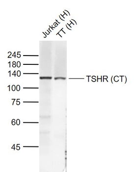 TSHR (CT) Rabbit Polyclonal Antibody