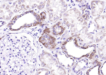 TSLP Rabbit Polyclonal Antibody