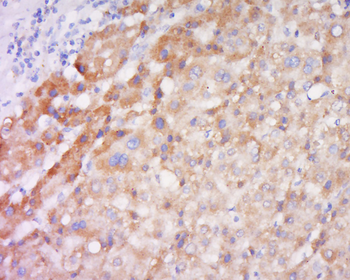 TSLP Rabbit Polyclonal Antibody