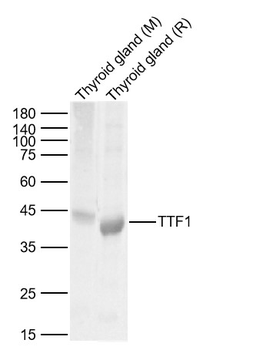 TTF1/NKX2-1 Rabbit Polyclonal Antibody