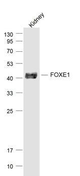 FOXE1 Rabbit Polyclonal Antibody