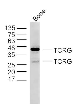 TRGC2 Rabbit Polyclonal Antibody