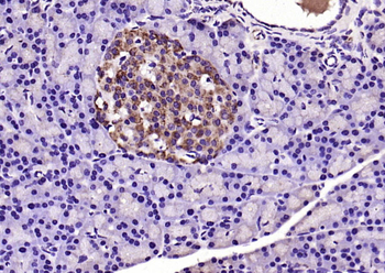 Galectin 9 Rabbit Polyclonal Antibody