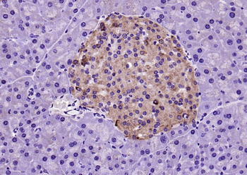 Galectin 9 Rabbit Polyclonal Antibody