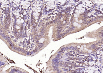 VHL Rabbit Polyclonal Antibody