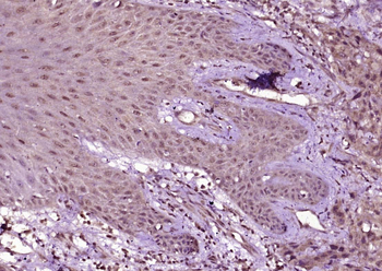 Ubiquitin Rabbit Polyclonal Antibody