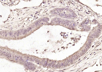 VCP Rabbit Polyclonal Antibody