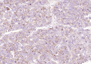 VEGFR1 Rabbit Polyclonal Antibody