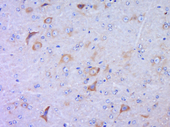 VEGFR3 Rabbit Polyclonal Antibody