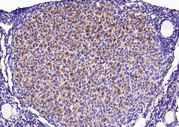 Vimentin Rabbit Polyclonal Antibody