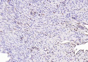 Vimentin Rabbit Polyclonal Antibody