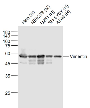 Vimentin Rabbit Polyclonal Antibody