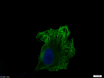 Vimentin Rabbit Polyclonal Antibody