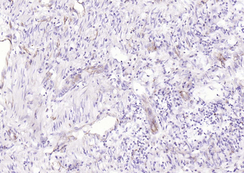 Vimentin Rabbit Polyclonal Antibody