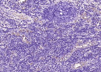 Vimentin Rabbit Polyclonal Antibody