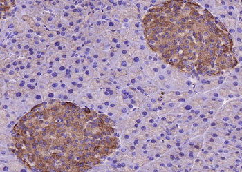 Visfatin Rabbit Polyclonal Antibody