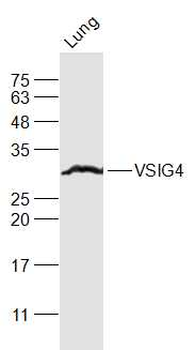 VSIG4 Rabbit Polyclonal Antibody