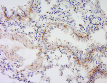 VSIG4 Rabbit Polyclonal Antibody