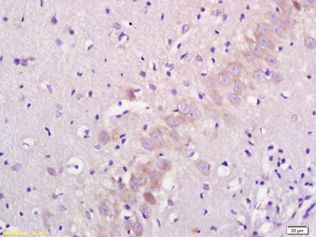 5-HTR2B Rabbit Polyclonal Antibody