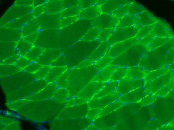 Desmuslin Rabbit Polyclonal Antibody