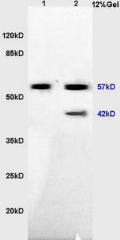 IRX4 Rabbit Polyclonal Antibody