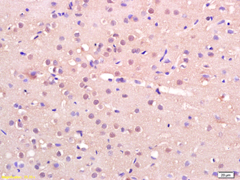 IRX4 Rabbit Polyclonal Antibody