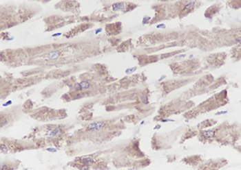 PCCB Recombinant Mouse Monoclonal Antibody