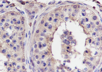 FKBPL Recombinant Mouse Monoclonal Antibody
