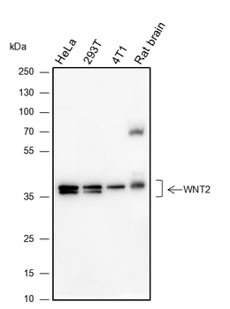 WNT2 Recombinant Mouse Monoclonal Antibody