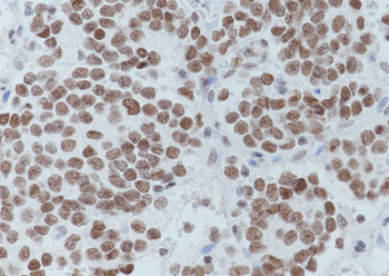 Acetyl-Histone H4 (Lys5) Rabbit Polyclonal Antibody