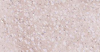 ALDH1L1 Recombinant Rabbit Monoclonal Antibody