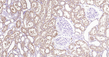 ALDH1L1 Recombinant Rabbit Monoclonal Antibody
