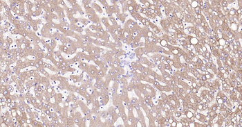 ALDH1L1 Recombinant Rabbit Monoclonal Antibody