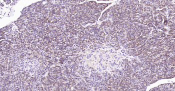 ALDH1L1 Recombinant Rabbit Monoclonal Antibody